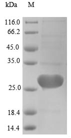 Recombinant Human cDNA FLJ56323, highly similar to Methylated-DNA--protein-cysteinemethyltransferase (EC 2.1.1.63),partial