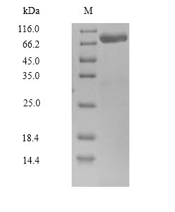 Recombinant Human Calpain-14(CAPN14),partial