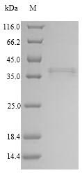 Recombinant Human Collectin-11(COLEC11)