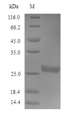 Recombinant Human Acetylcholine receptor subunit gamma(CHRNG),partial