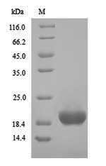 Recombinant Clostridium botulinum Hemagglutinin component of the neurotoxin complex(ha17)