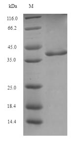 Recombinant Blattella germanica Glutathione S-transferase