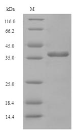 Recombinant Saccharomyces cerevisiae Diphosphoinositol polyphosphate phosphohydrolase DDP1(DDP1)