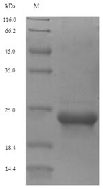 Recombinant Human Type-2 angiotensin II receptor(AGTR2),partial