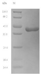Recombinant Saccharum officinarum Sucrose synthase(SUS1)