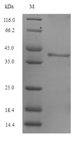 Recombinant Arabidopsis thaliana Sucrose-phosphate synthase 1(SPS1),partial