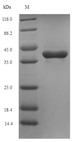Recombinant Mycobacterium tuberculosis Thymidylate kinase(tmk)