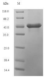 Recombinant Zea mays (Maize) Sucrose synthase 1(SH-1),partial
