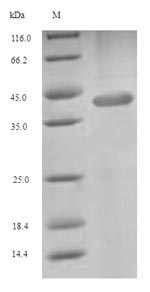 Recombinant Human Excitatory amino acid transporter 4(SLC1A6),partial