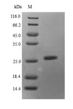 Recombinant Mouse Histone deacetylase complex subunit SAP130(Sap130),partial