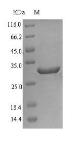 Recombinant Human Fatty acid desaturase 2(FADS2),partial