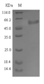 Recombinant Staphylococcus aureus Serine-aspartate repeat-containing protein E(sdrE) ,partial