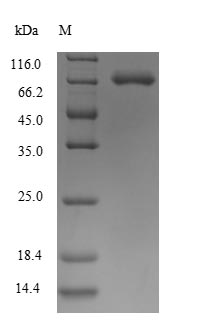 Recombinant Human Semaphorin-7A(SEMA7A)