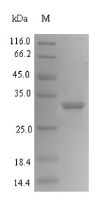 Recombinant Human Mediator of DNA damage checkpoint protein 1(MDC1),partial