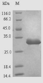Recombinant Hepatitis B virus genotype D subtype ayw Protein X(X)