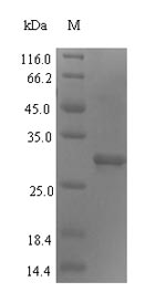 Recombinant Human DNA repair protein complementing XP-G cells(ERCC5),partial