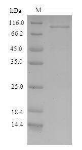 Recombinant Paracoccus denitrificans Nitrous-oxide reductase(nosZ)