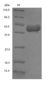 Recombinant Triticum aestivum Omega-5 gliadinImported ,partial