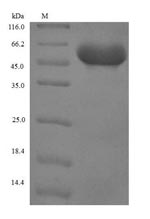 Recombinant Human Serpin B4(SERPINB4)