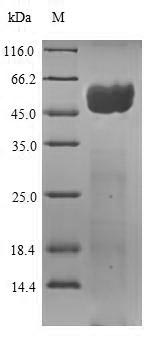 Recombinant Zaire ebolavirus Envelope glycoprotein(GP),partial