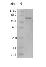 Recombinant Newcastle disease virus Nucleoprotein(N)
