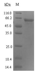 Recombinant Human Proteasomal ubiquitin receptor ADRM1(ADRM1)