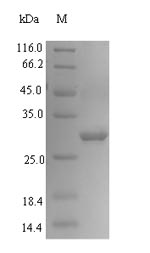 Recombinant Entamoeba histolytica Calreticulin