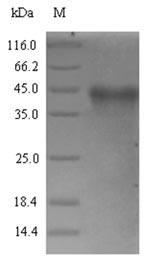 Recombinant Rickettsia conorii Putative N-acetylmuramoyl-L-alanine amidase RC04(RC0497)