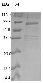 Recombinant Human COP9 signalosome complex subunit 2(COPS2)