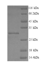 Recombinant Human Phospholysine phosphohistidine inorganic pyrophosphate phosphatase(LHPP)