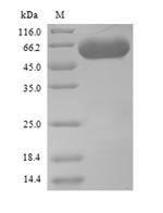 Recombinant Saccharomyces cerevisiae Serine--tRNA ligase, Cytoplasmic domain(SES1)