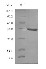 Recombinant Geobacillus stearothermophilus ATP-dependent DNA helicase PcrA(pcrA),partial