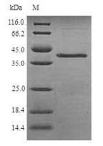 Recombinant Schizosaccharomyces pombe NADH kinase pos5, mitochondrial(pos5)