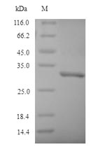 Recombinant Mouse NAD(P)H dehydrogenase [quinone] 1(Nqo1)
