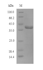 Recombinant Human N-glycosylase/DNA lyase(OGG1)