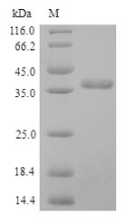 Recombinant Human Pulmonary surfactant-associated protein D(SFTPD)