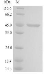 Recombinant Human Cell growth-regulating nucleolar protein(LYAR)