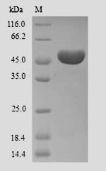 Recombinant Human Ameloblastin(AMBN)