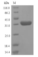 Recombinant Human Transmembrane protease serine 2(TMPRSS2),partial