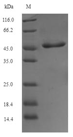 Recombinant Dermatophagoides pteronyssinus Tropomyosin