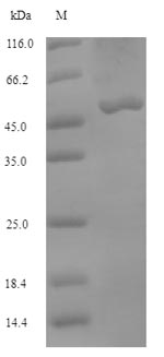 Recombinant Bovine Bifunctional methylenetetrahydrofolate dehydrogenase/cyclohydrolase, mitochondrial(MTHFD2)