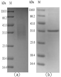 Recombinant Mouse Legumain(Lgmn)