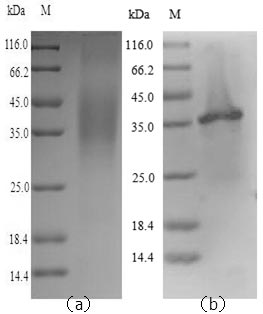 Recombinant Human Legumain(LGMN)
