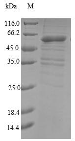Recombinant Human Probable E3 ubiquitin-protein ligase makorin-3(MKRN3)