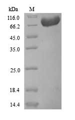 Recombinant Human Prothrombin(F2)