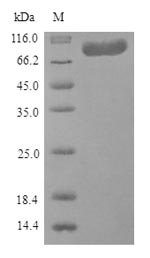 Recombinant Human Coagulation factor XIII A chain(F13A1)