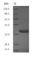 Recombinant Influenza A virus Hemagglutinin(HA),partial