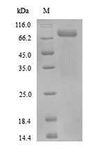 Recombinant Human Protein-arginine deiminase type-3(PADI3)