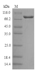 Recombinant Human Galactocerebrosidase(GALC)