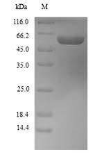 Recombinant Mouse Retinal dehydrogenase 1(Aldh1a1)